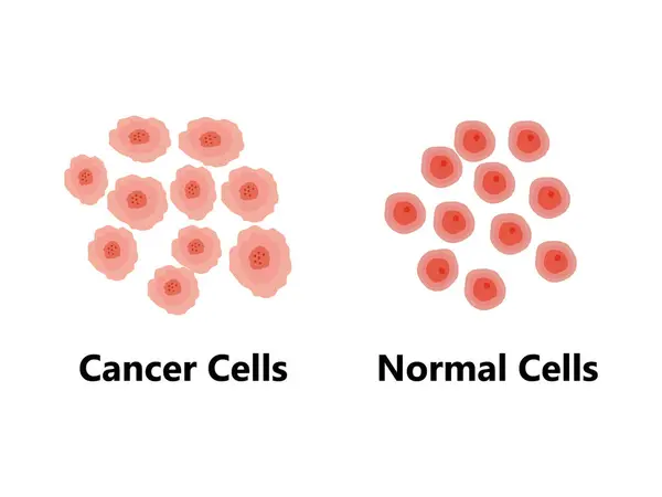 Divisão Células Normais Câncer Perda Controlo Normal Crescimento Das Células Ilustração De Stock