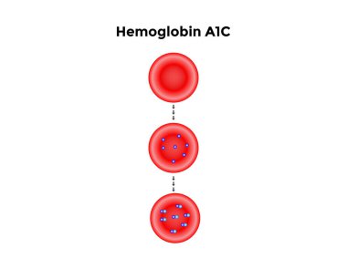 Glikozlu hemoglobin oluşumunun Bilimsel Tasarımı. Renkli semboller. Vektör İllüstrasyonu.
