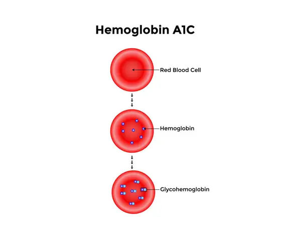 Glikozlu hemoglobin oluşumunun Bilimsel Tasarımı. Renkli semboller. Vektör İllüstrasyonu.