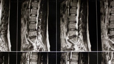 İnsan sırtı ve belinin röntgenleri. Tıbbi konular. Hastalıkların tedavisi. Yaralar ve rehabilitasyon. Hastane, poliklinik, ofis, hasta