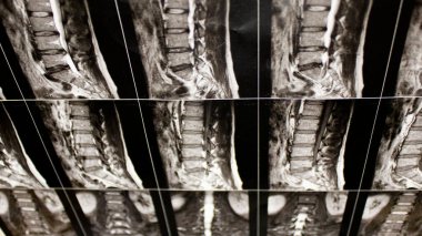 İnsan sırtı ve belinin röntgenleri. Tıbbi konular. Hastalıkların tedavisi. Yaralar ve rehabilitasyon. Hastane, poliklinik, ofis, hasta