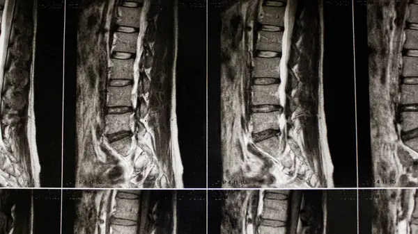 İnsan sırtı ve belinin röntgenleri. Tıbbi konular. Hastalıkların tedavisi. Yaralar ve rehabilitasyon. Hastane, poliklinik, ofis, hasta