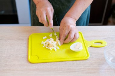 Kadın kesme tahtasında sebze kesiyor. Sebzeler soğan ve sarımsak. Kadın sebzeleri kesmek için bıçak kullanıyor.