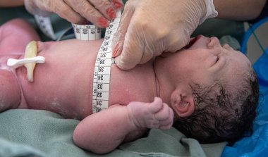 Doktor yenidoğan üzerinde ölçüm yapıyor.