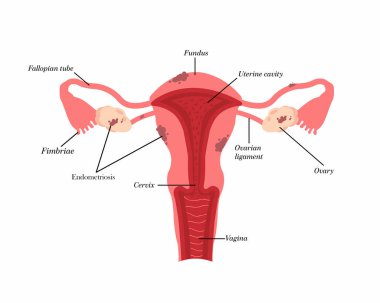 Rahim anatomisi endometriyozisi pelvik organların yapısı. Jinekoloji.