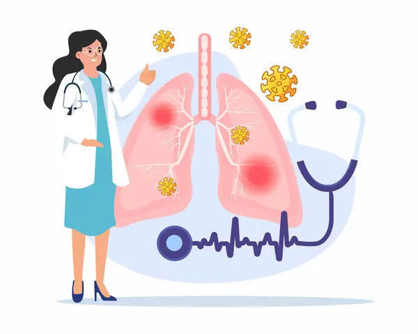 Лікарі Досліджують Легені Уражені Пневмонією Лікування Раку Легенів Або Діагностику — стоковий вектор