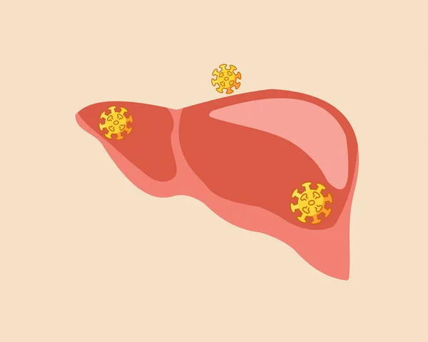 Hepatit Virüsü Sembollü Insan Karaciğeri Dünya Hepatit Farkındalığı Günü — Stok Vektör