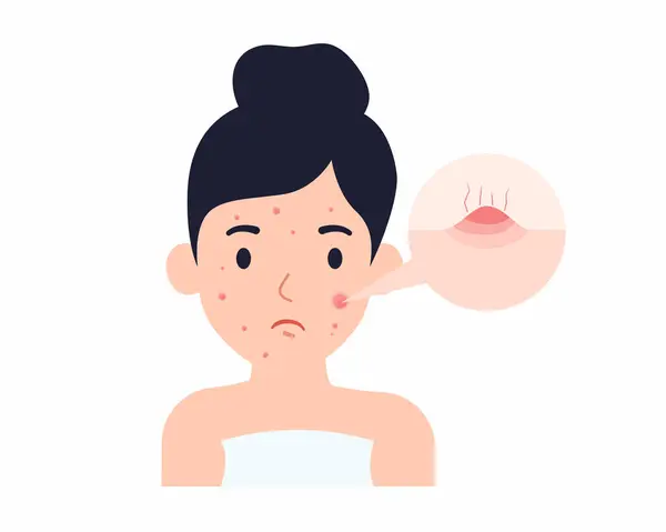 Young Women Showing Her Face Pimple Red Spots Health Problem — Stock Vector