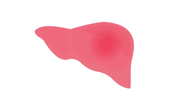Leversmärta Och Inflammation Orsakad Fettlever Hepatit Sjukdom Medicinsk Animation — Stockvideo
