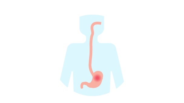 Dolore Allo Stomaco Ulcera Gastrica Malattia Del Sistema Gastrointestinale Concetto — Video Stock
