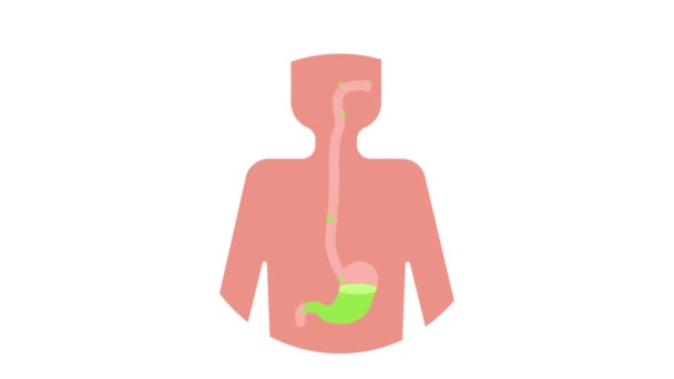 人間の胃の酸性度 胃食道逆流病アニメーション — ストック動画