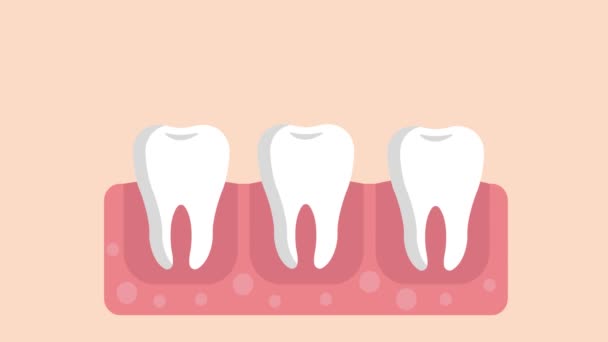 Jak Vyčistit Zuby Zubní Koncept Animace — Stock video