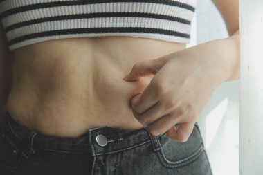 Kadın göbeği. Şişman kadın göbek yağlarını tutuyor. diyet yaşam tarzı konsepti karın kaslarını zayıflatmak ve sağlıklı mide kaslarını şekillendirmek için.