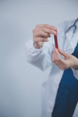 Laboratuvarda kan örnekleri ve askılarla çalışan teknisyen, doktor, bilim adamı. Laboratuvarda üzerinde çalışmak, deney ve tıbbi araştırma biyoteknoloji DNA testi için bir kan damarı örneği tutuyor..