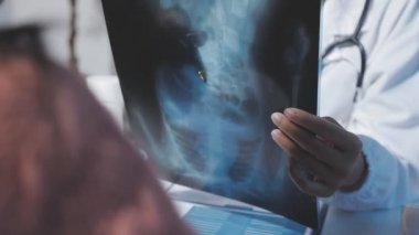 Göğüs röntgenini çekerken doktor elini kapat.