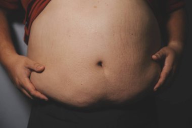 Asyalı şişman bir adam aynanın önünde vücuduna bakıyor. Aşırı göbek yağı, sağlıksız yaşam tarzı, diyet konsepti.