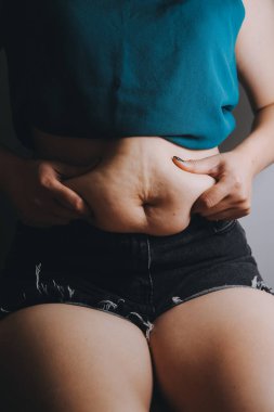 Şişman kadın, şişko, obez kadın el ele tutuşan ölçü bandıyla göbek yağı, kadın diyeti yaşam tarzı konsepti