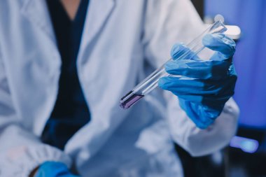 Laboratuvarda mikroskop kullanan bir bilim adamı. Laboratuvar ortamında modern bir mikroskobu ayarlayan bir araştırmacının ellerine yakın çekim. Bilim konsepti