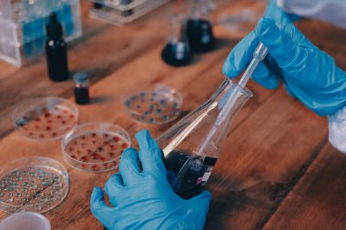 Laboratuvarda kan testi. Dispanser ile çalışan laboratuvar asistanı. Kanlı vakum tüpleri..