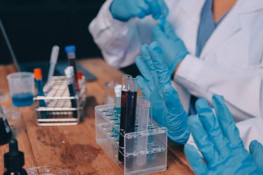 Laboratuvarda kan testi. Dispanser ile çalışan laboratuvar asistanı. Kanlı vakum tüpleri..