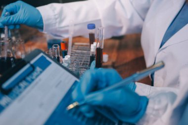 Laboratuvarda kan testi. Dispanser ile çalışan laboratuvar asistanı. Kanlı vakum tüpleri..