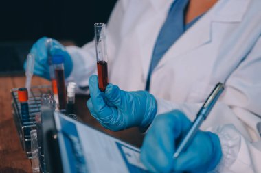 Laboratuvarda kan testi. Dispanser ile çalışan laboratuvar asistanı. Kanlı vakum tüpleri..