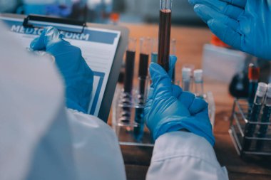 Laboratuvarda kan testi. Dispanser ile çalışan laboratuvar asistanı. Kanlı vakum tüpleri..