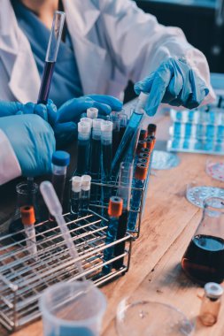 Laboratuvarda kan testi. Dispanser ile çalışan laboratuvar asistanı. Kanlı vakum tüpleri..