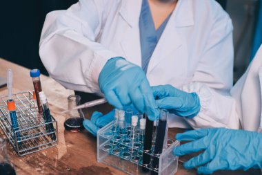 Laboratuvarda kan testi. Dispanser ile çalışan laboratuvar asistanı. Kanlı vakum tüpleri..