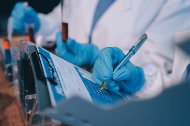 Laboratuvarda kan testi. Dispanser ile çalışan laboratuvar asistanı. Kanlı vakum tüpleri..