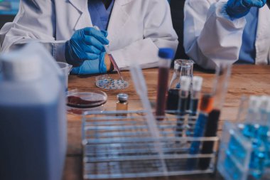 Laboratuvarda kan testi. Dispanser ile çalışan laboratuvar asistanı. Kanlı vakum tüpleri..