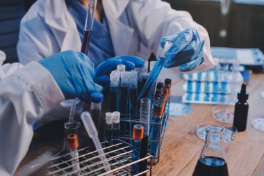 Laboratuvarda kan testi. Dispanser ile çalışan laboratuvar asistanı. Kanlı vakum tüpleri..