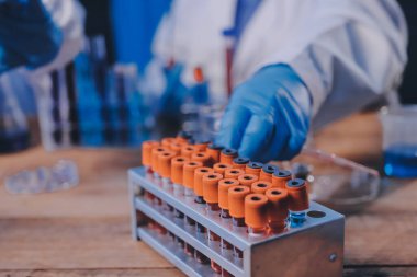 Laboratuvarda kan testi. Dispanser ile çalışan laboratuvar asistanı. Kanlı vakum tüpleri..