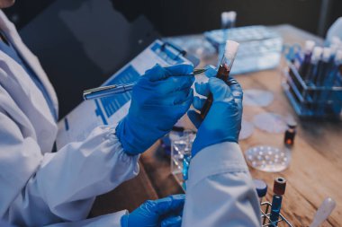 Laboratuvarda kan testi. Dispanser ile çalışan laboratuvar asistanı. Kanlı vakum tüpleri..