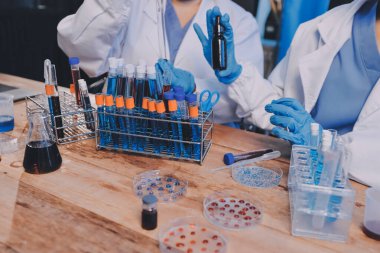 Laboratuvarda kan testi. Dispanser ile çalışan laboratuvar asistanı. Kanlı vakum tüpleri..