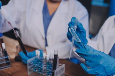 Laboratuvarda kan testi. Dispanser ile çalışan laboratuvar asistanı. Kanlı vakum tüpleri..