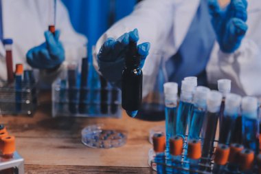 Laboratuvarda kan testi. Dispanser ile çalışan laboratuvar asistanı. Kanlı vakum tüpleri..