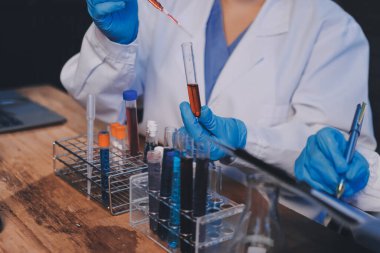 Laboratuvarda kan testi. Dispanser ile çalışan laboratuvar asistanı. Kanlı vakum tüpleri..