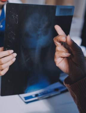 Doktor, emekliye ayrılmış yaşlı kadına akciğer röntgeni çeken hastanın sağlık ve hayat sigortası planlarını kullanarak hastane bakım evindeki hastalara tedavi yöntemlerini anlattı.