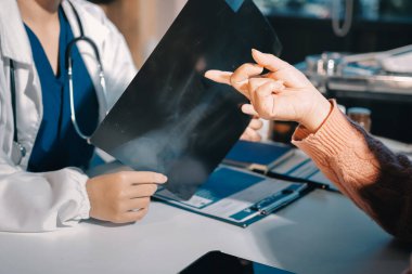 Doktor, emekliye ayrılmış yaşlı kadına akciğer röntgeni çeken hastanın sağlık ve hayat sigortası planlarını kullanarak hastane bakım evindeki hastalara tedavi yöntemlerini anlattı.