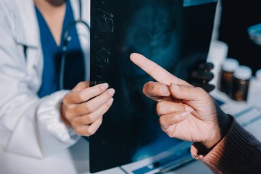 Doktor, emekliye ayrılmış yaşlı kadına akciğer röntgeni çeken hastanın sağlık ve hayat sigortası planlarını kullanarak hastane bakım evindeki hastalara tedavi yöntemlerini anlattı.