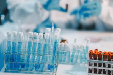 Araştırma, deney ve tıbbi deney laboratuvarda, bilim tesisinde ya da hastanede bir bilim adamı tarafından yapılıyor. Bir genç, ciddi ve profesyonel araştırmacı bir keşif yapıyor, düzenliyor ya da düzenliyor.