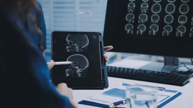 Dijital röntgen kullanan bir kadın doktoru kapatın.