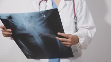 Beyaz önlüklü erkek doktor elinde röntgen filmi tutuyor.