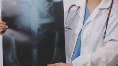 Doktor elinde bir hastanın röntgenini tutuyor..