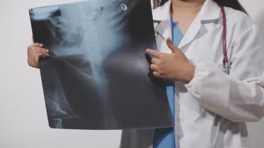 Doktor X-ray görüntüsü tutuyor