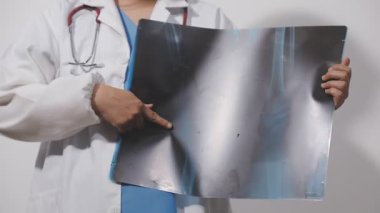 Elinde beyaz bir röntgen olan doktor, sağına yakın.