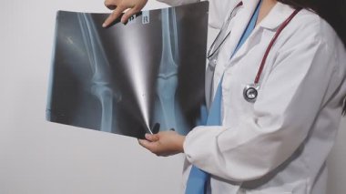 Genç doktor elinde röntgen tutuyor.