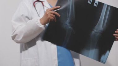 Doktor X-ray 'i elinde tutuyor, izole edilmiş.