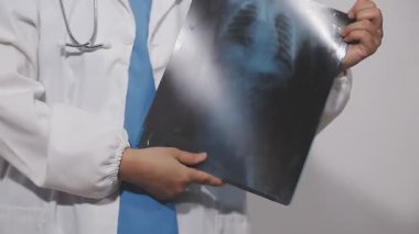 Genç doktor X-ray 'i elinde tutuyor..